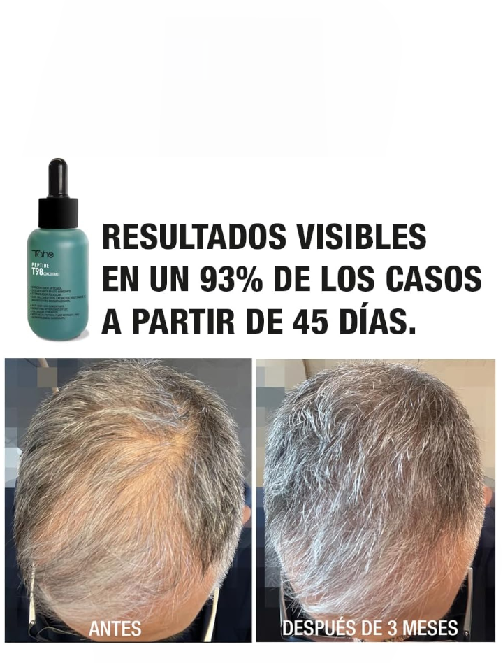 Tahe Peptide T98 Anticaída – Tratamiento Densificante Intensivo 50 ml